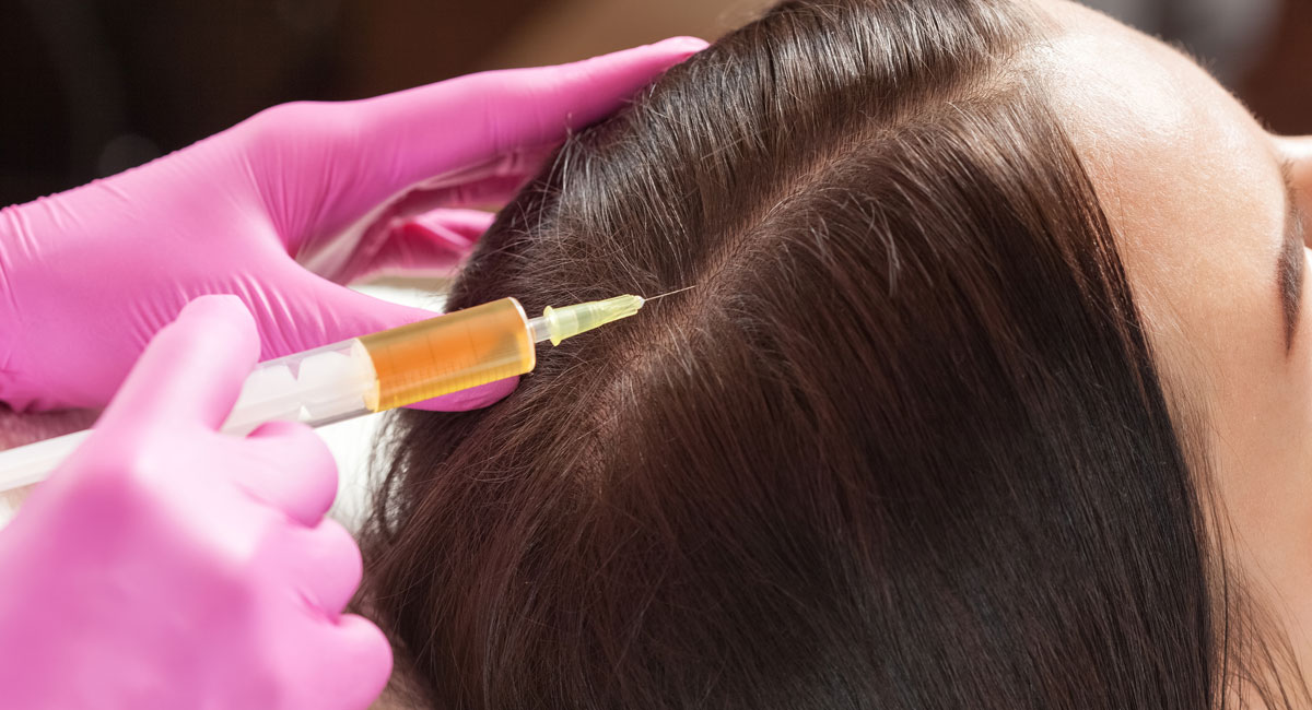 PRP for Hair Regrowth